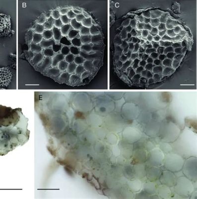  Hartmannella Een microscopisch wonder met een onberoepeelbare eetlust en een fascinerende manier om zich voort te bewegen!